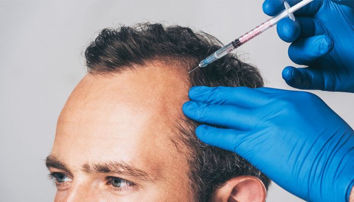 HAIR Restoration Treatment